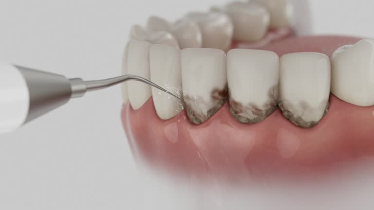 Reliable Dental Implants contractor in Ormond Beach, FL by Smile Center Dentistry